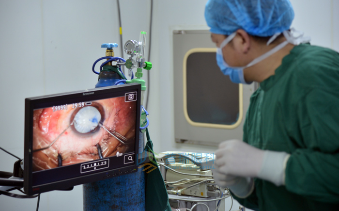 詳解白內(nèi)障到底會不會傳染？