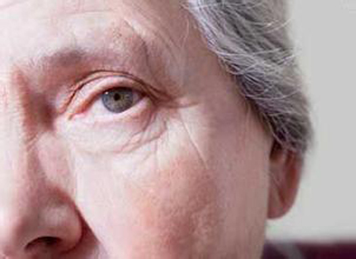 了解初期白內(nèi)障癥狀,再去