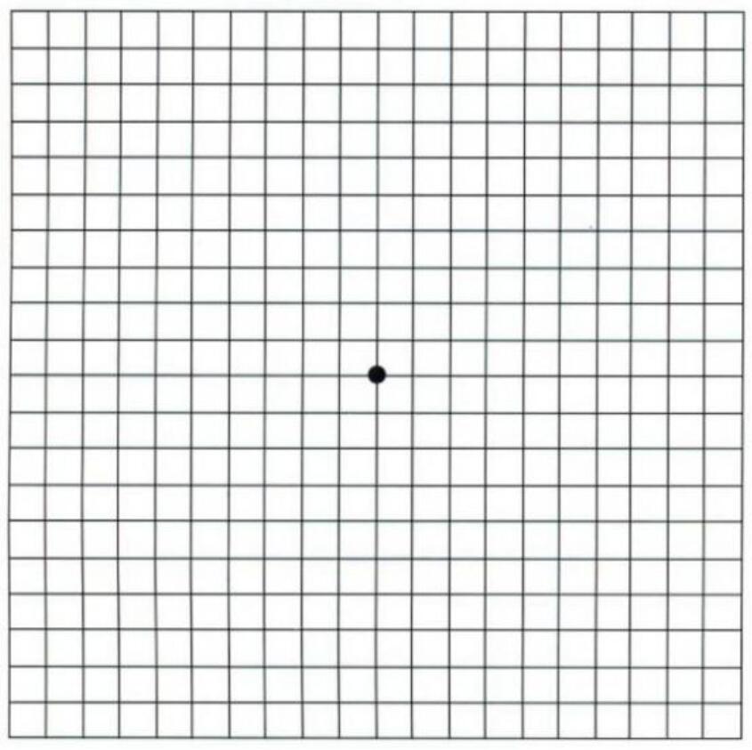 知道嗎？熬夜多了，你的眼睛也就“黃了”  很多年輕人為了