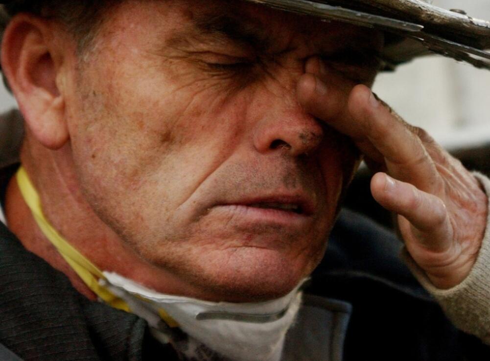 得了白內(nèi)障眼睛會(huì)疼痛嗎?