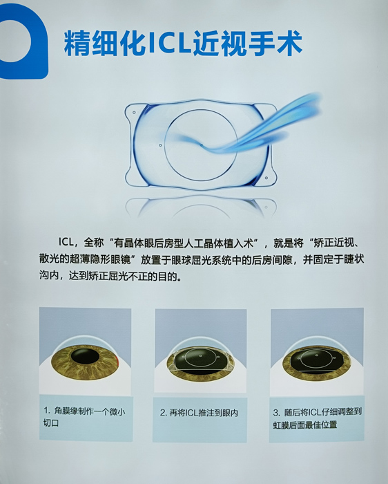 寒假摘鏡總動員，近視朋友的三種矯正近視方式